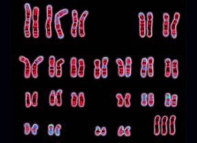 Das Unternehmen GATC Biotech erkennt das berzhlige dritte Chromosom (hier oben links) anhand einer Untersuchung von DNA-Fragmenten des Kindes im Blut der Mutter.